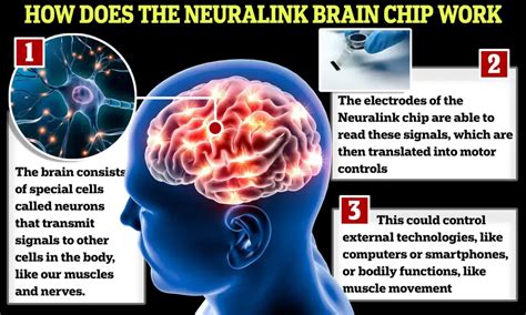 Neuralink: Elon Musk's Brain-Machine Interface Technology and Its Effects - MIM Learnovate