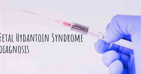 How is Fetal Hydantoin Syndrome diagnosed?