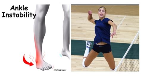 Volleyball Ankle Stability Exercises - Reids Workouts