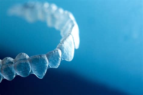 The Pros and Cons of Invisible Aligners