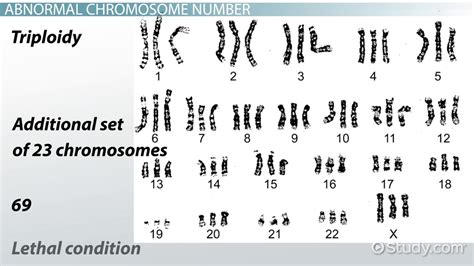 How To Determine Number Of Chromosomes