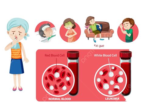 Leukemia Symptoms Cartoon Style Infographic Healthy Symptoms Frame ...