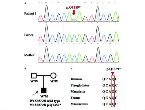 | Detection of KMT2B nonsense mutation p.Q1359* in patient 1. (A) DNA... | Download Scientific ...