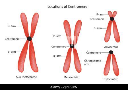 types of chromosomes. Structure of chromosome with centromere, long and short arms. Metacentric ...