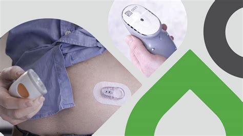 Dexcom ONE Children CGM System | Dexcom