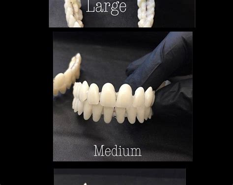 How To Make Your Own Teeth Veneers - DIY Denture Kit Best Denture Kit Create Your Own Denture ...