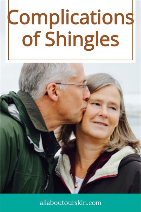 Shingles rash – Artofit