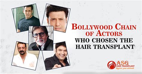 Bollywood Chain Of Actors Who Chose Hair Transplant.