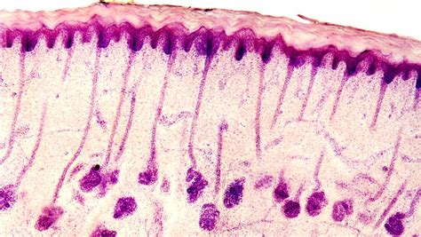 Skin Sweat Glands, Light Micrograph Photograph by Dr Keith Wheeler