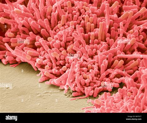 Plaque-forming bacteria, coloured scanningelectron micrograph (SEM). Dental plaque is a biofilm ...