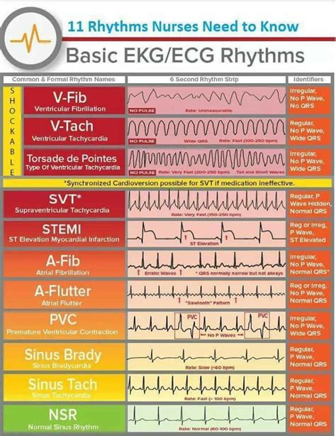 #cardiacfitness | Nurse, Nursing notes, Nursing mnemonics