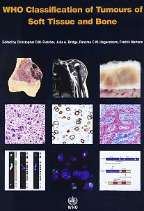 Carcinoma Is A Cancer Originating From What Tissue - CancerWalls