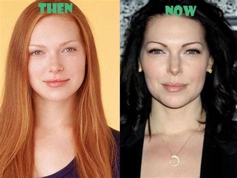 Laura Prepon Plastic Surgery Before And After Photo 76B