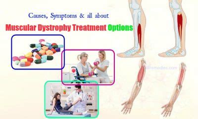 Causes, Symptoms & All About Muscular Dystrophy Treatment Options