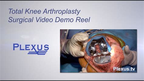 Total Knee Arthroplasty Surgical Video - YouTube