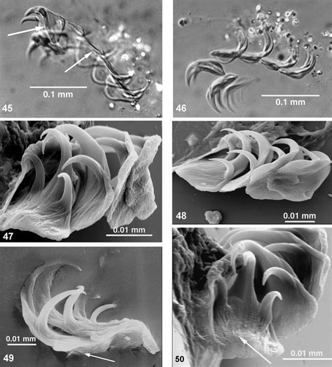 Hard and Soft Anatomy in Two Genera of Dondersiidae (Mollusca, Aplacophora, Solenogastres) (PDF ...