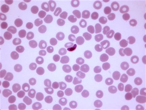 Plasmodium falciparum