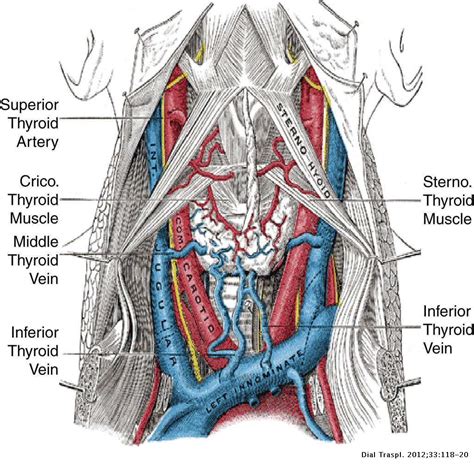 The jugular approach | Diálisis y Trasplante