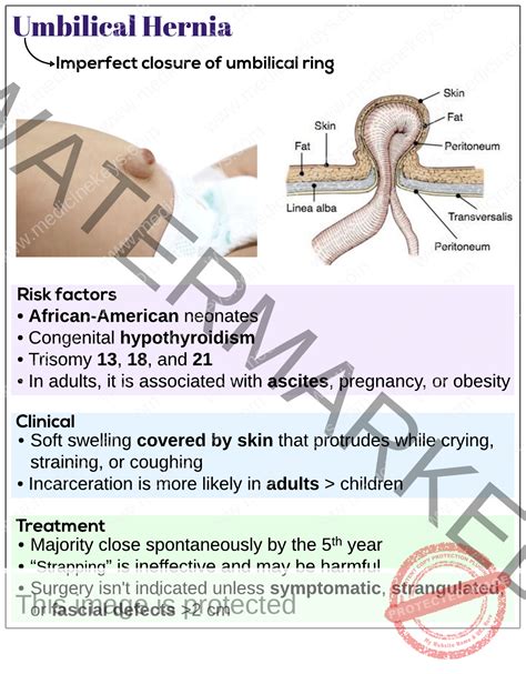 Umbilical hernia - Medicine Keys for MRCPs