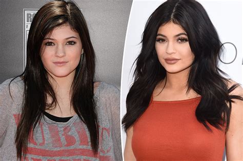 Fans roast Kylie Jenner for 'lying' about plastic surgery