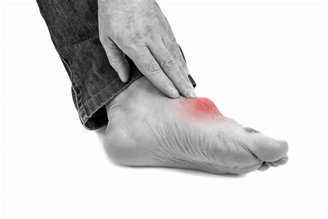 Lower Limb Arthritis and the effectiveness of Soft Tissue Laser and Foot Orthoses - Mary Moore ...