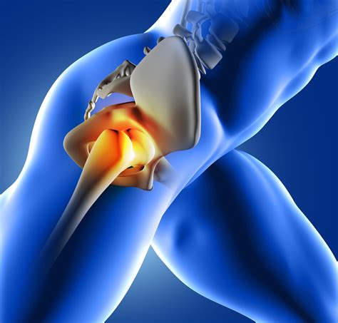 It's Hip to be Pain-Free: Tackling Hip Tendonitis | Fit Club NY