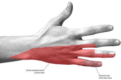 Ulnar nerve anatomy, innervation, injury, damage, palsy & entrapment