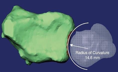 The 3-D analysis of sigmoid notch radius of curvature. | Download Scientific Diagram