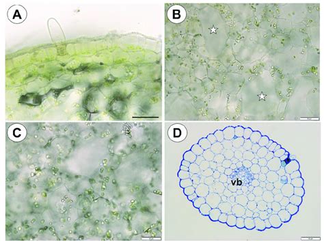 Tuber and stolon structure of Utricularia mannii. A. Chloroplasts in... | Download Scientific ...