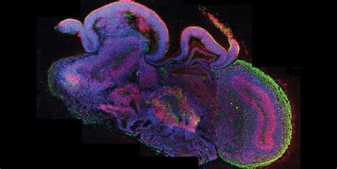 Scientists Create Mini Human Brains in Lab Dish - Industry Tap