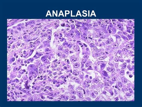 General pathology lecture 4 cellular adaptation