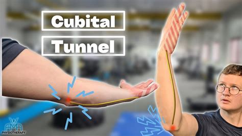 The BEST Exercises For Cubital Tunnel Syndrome! - YouTube