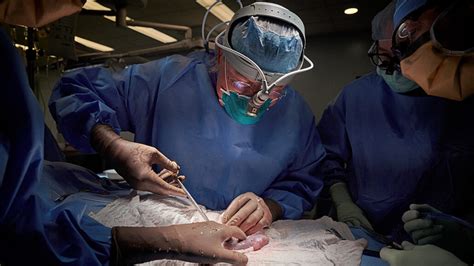 Will animal-to-human organ transplants overcome their complicated ...