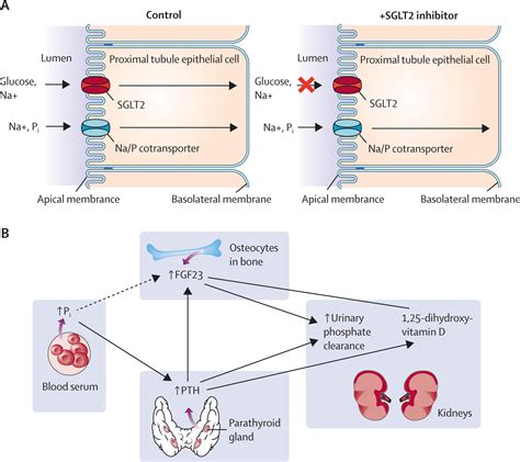 Dapagliflozin A Novel Sglt2 Inhibitor