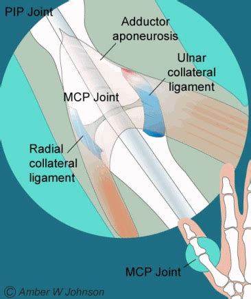 Normal Thumb MCP joint.gif (366×435) | Medical conditions, Ligament tear, Team hope