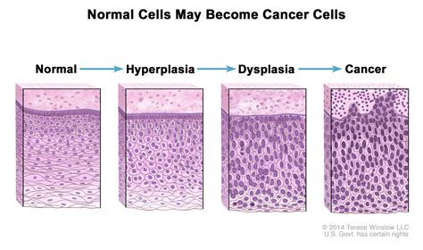 What is Thymic Cancer? – Foundation for Thymic Cancer Research