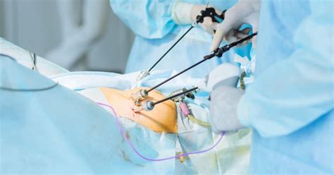 Laparoscopic Surgery: Purpose, Procedure, And Benefits