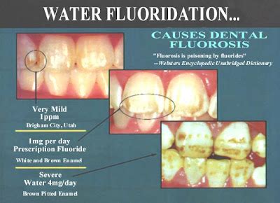 Susan's Blog: Fluoride in Your Water?