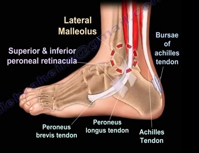 Everything You Need To Know About Ankle Pain And Ankle Injury ...