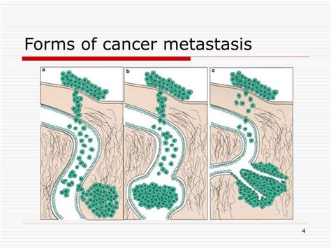 PPT - Molecular mechanism of cancer metastasis PowerPoint Presentation ...