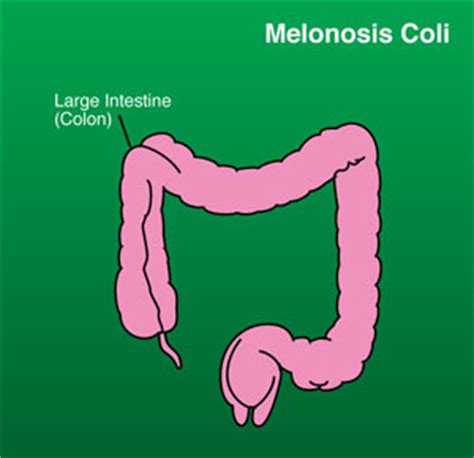 Melanosis Coli | Digestive Disease Center of CNY