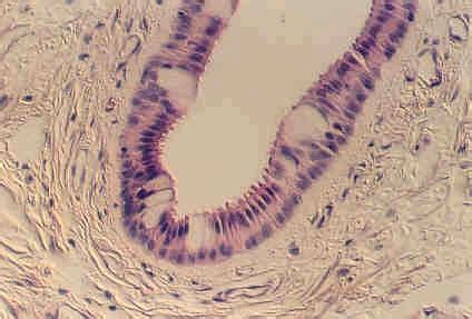 STRATIFIED COLUMNAR OR CUBOIDAL EPITHELIUM | Microanatomy Web Atlas | Gwen V. Childs, Ph.D.