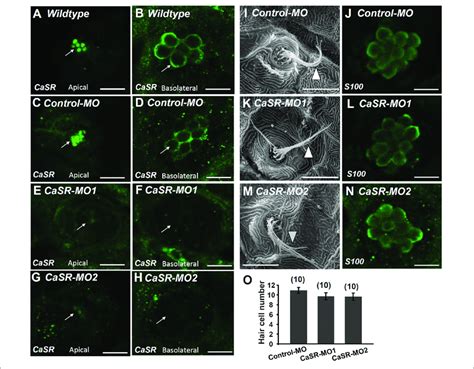 | Ca 2+-sensing receptor (CaSR) protein expression in neuromast hair... | Download Scientific ...