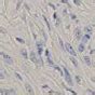 Types of Mesothelioma | Location, Cell Types & Malignancy