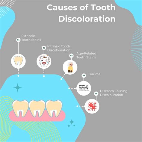 Tooth Discolouration: Types, Causes, and Prevention Methods - KWC Dental