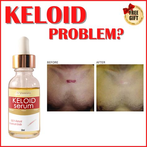 KELOID REMOVER Keloid Serum , keloid scar remover original , keloid ...