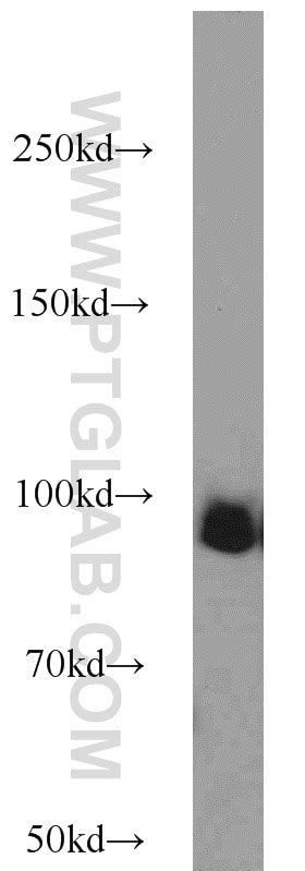 UHRF1 antibody (21402-1-AP) | Proteintech