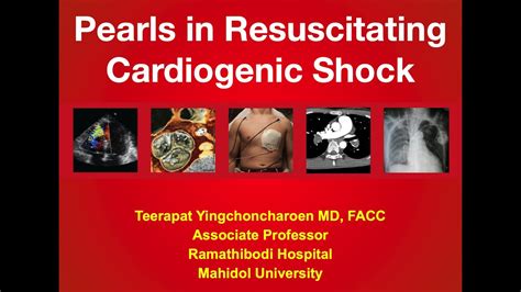 Cardiogenic shock part 1 : Overview, Definition, SCAI Stages, Etiology - YouTube