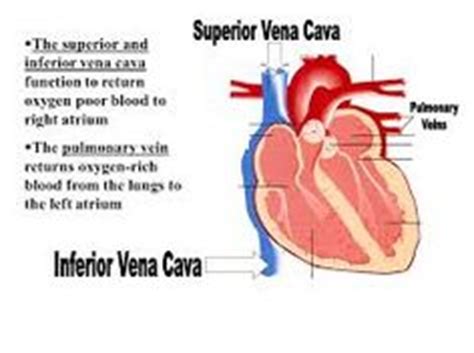 Interrupted Inferior Vena Cava (IVC)