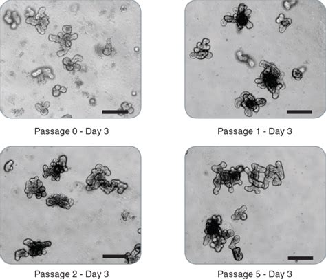 Intestinal Organoid Culture | STEMCELL Technologies